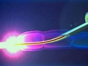 Laser bei der Arbeit