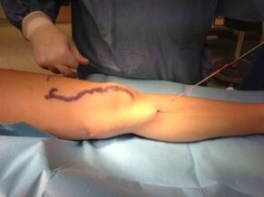 Operation